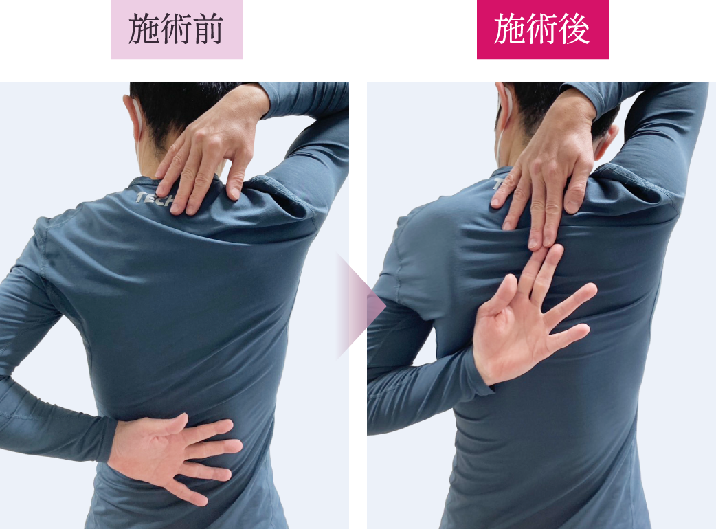 施術前と施術後の写真