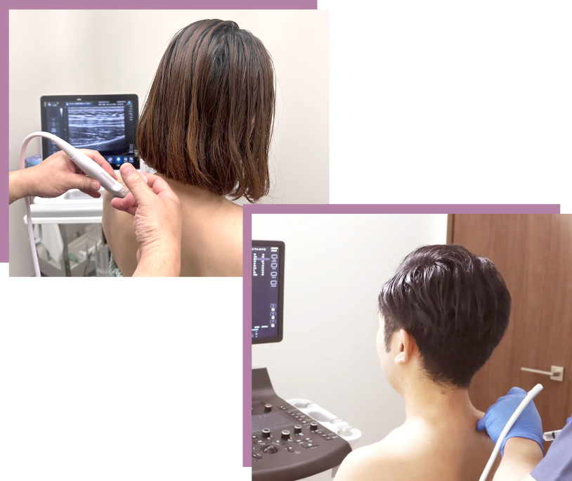 施術を受けている写真